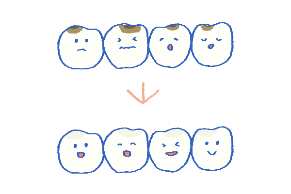 小さいむし歯