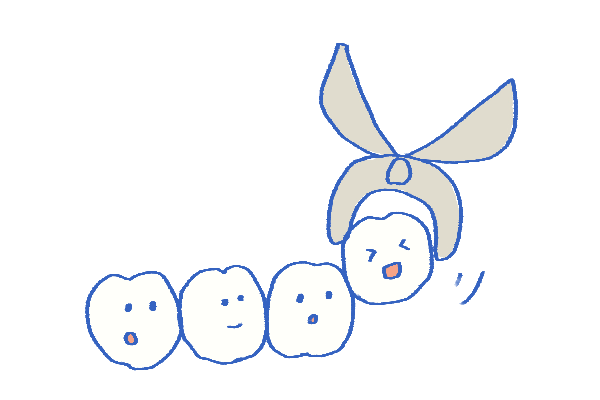 抜歯