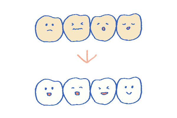 ホワイトニング